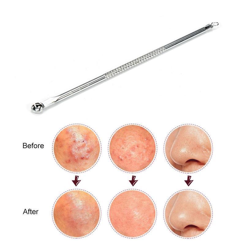 Blackhead Remover Comedone Blemish Acne Pimple Extractor Tool 202